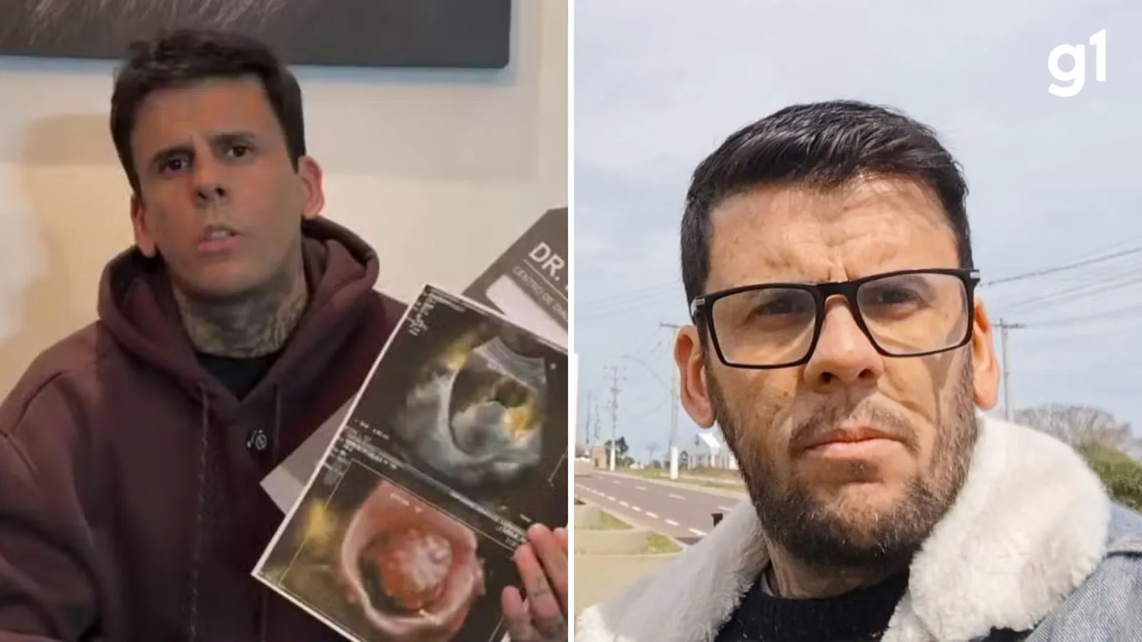 Leandro de Souza recebe alta após cirurgia para retirar tumor na bexiga