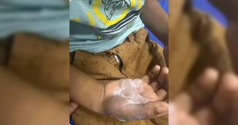 Irmãos são levados para acolhimento após suspeita de agressão em Goiás