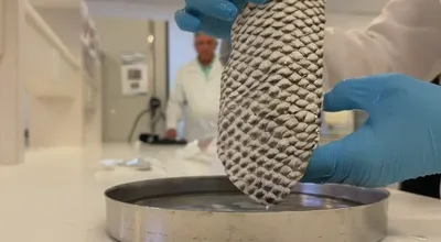 Pele de tilápia será produzida em escala industrial para tratar queimaduras