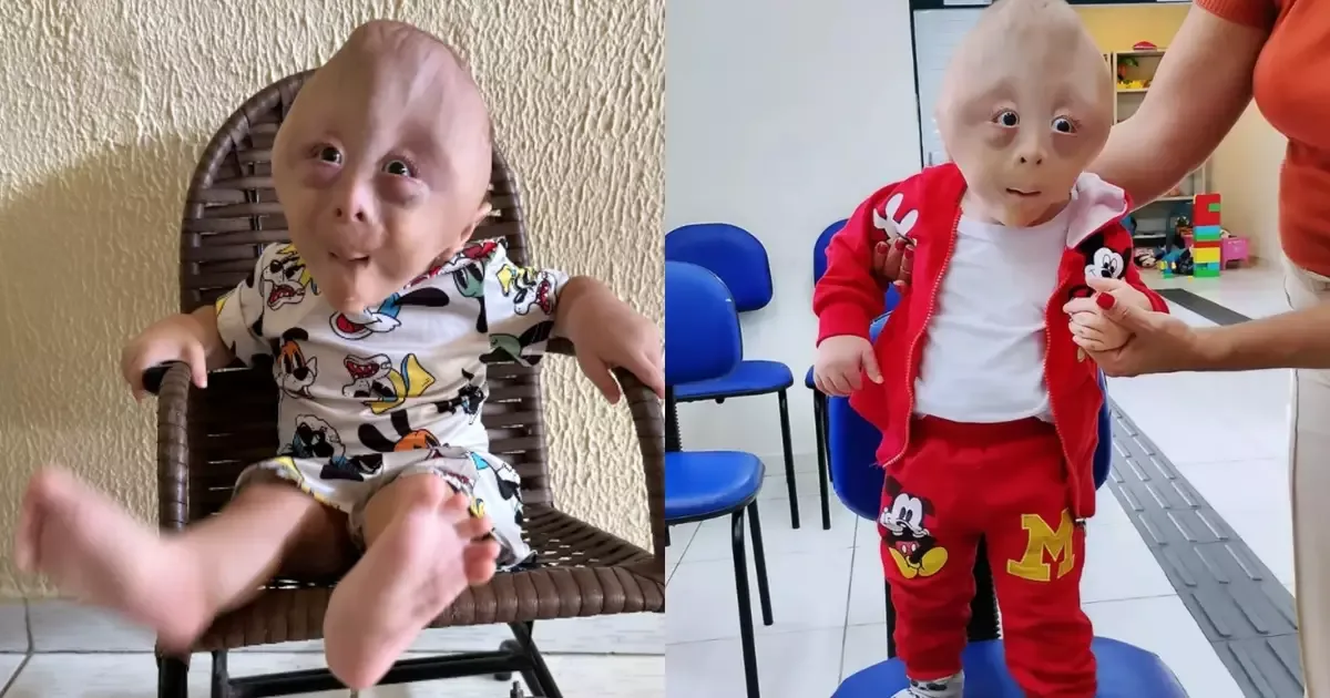 Família de Bayeux busca cuidados para bebê com alteração cromossômica rara